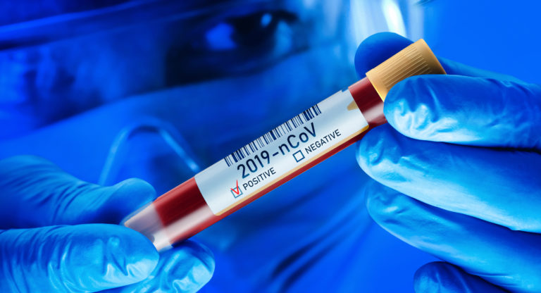 Chinese Coronavirus Blood Test Concept