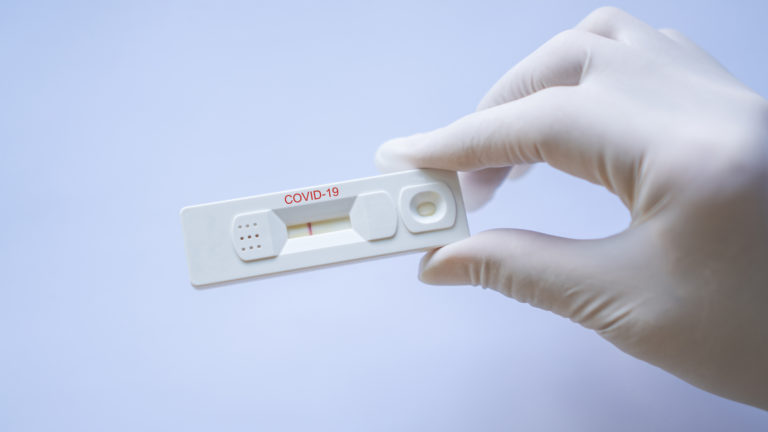 Koronavirus, test