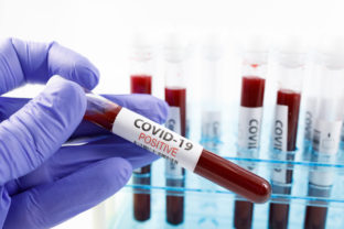 koronavirus test smrt umrtie
