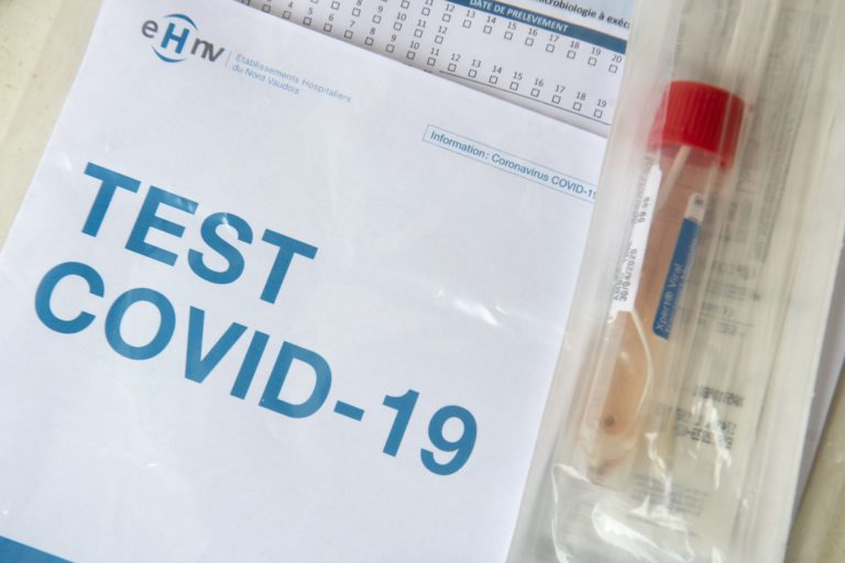 Test, Covid 19