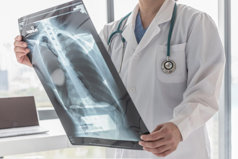 Doctor with radiological chest x ray film for medical diagnosis on patient's health on asthma, lung disease and bone cancer illness
