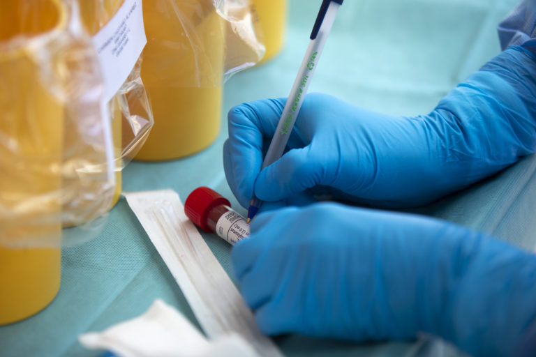 PCR test na Covid-19