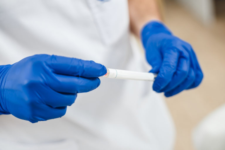 DNA, koronavírus, covid 19, odber vzorky, test