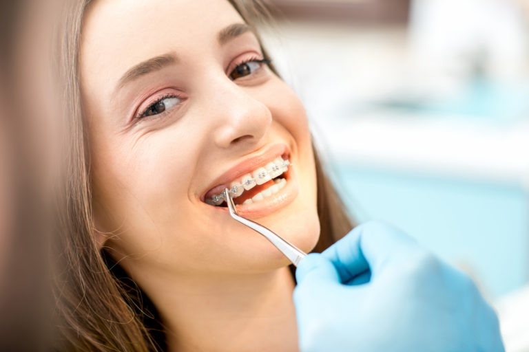 Woman's smile with dental braces