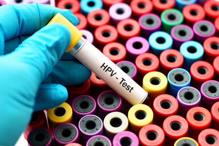 HPV test