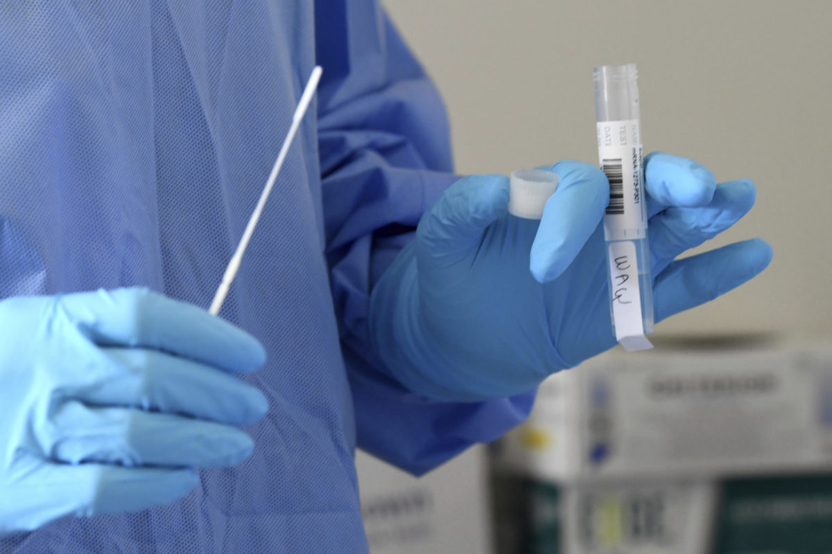 PCR test