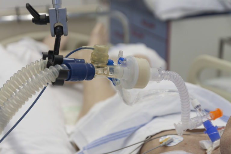 Koronavírus, pľúcny ventilátor, nemocnica, úmrtie