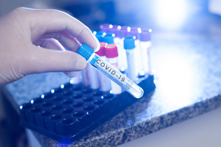 Covid 19 written on test tube