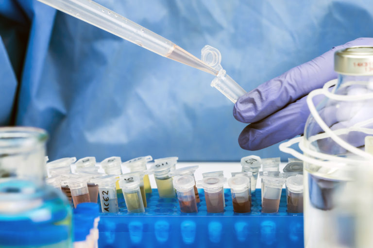 Laboratórium, testy, koronavirus