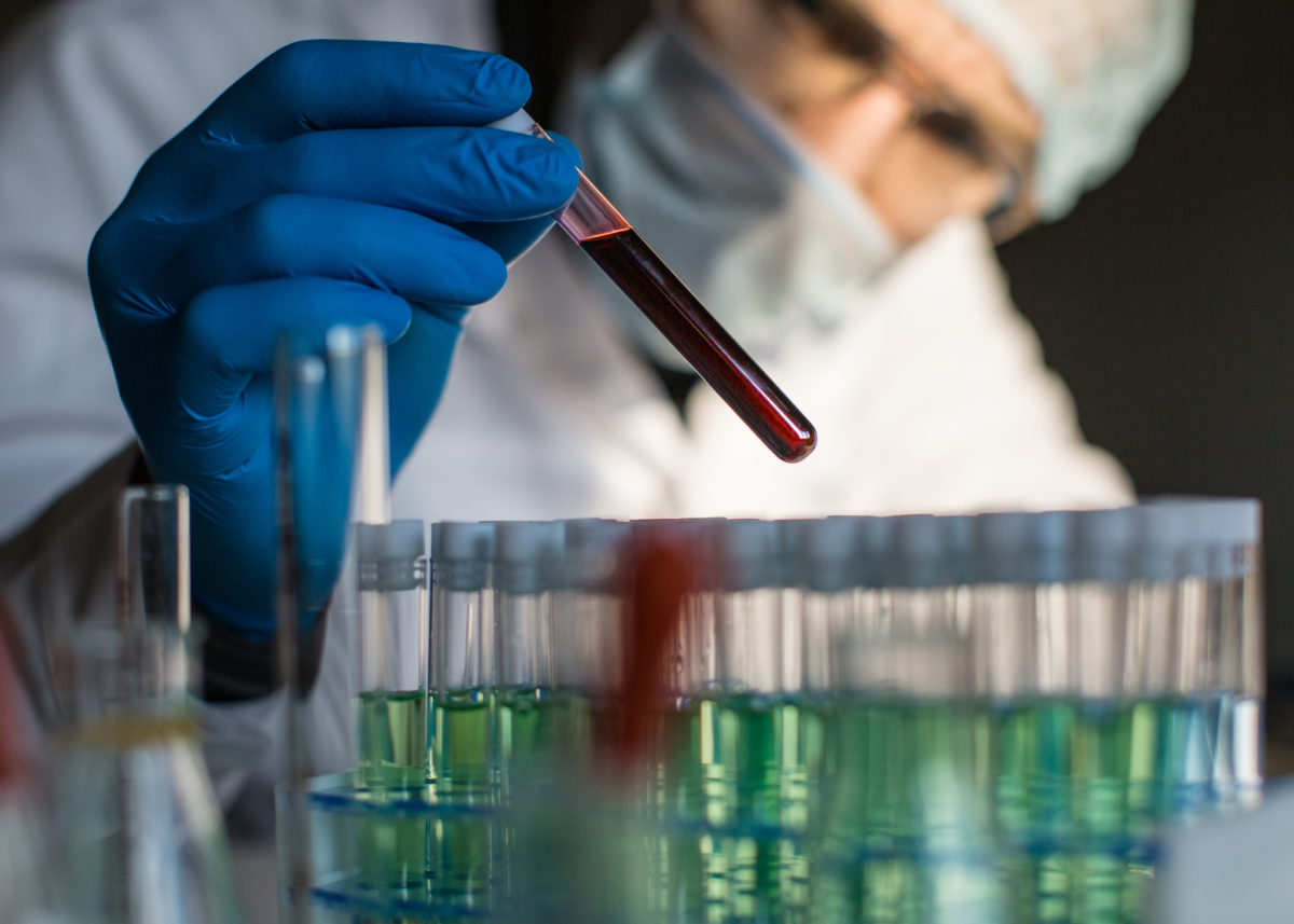 Laboratórium, koronavírus, imunita