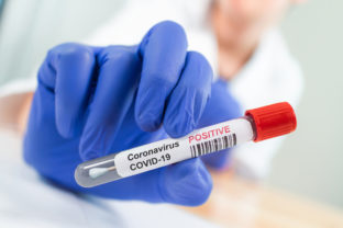 Coronavirus infected blood sample tube