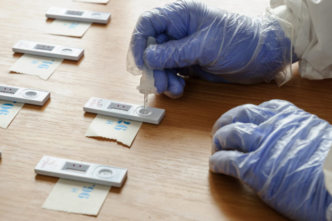 Antigenovy test, testovanie