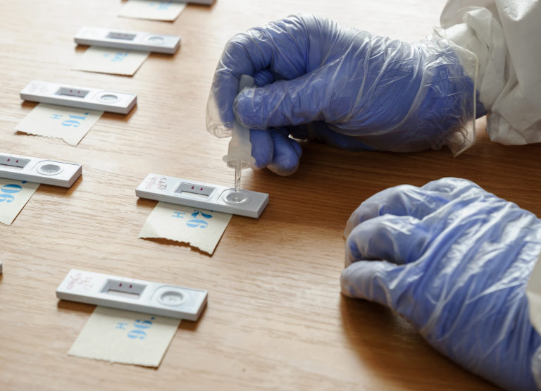 Antigenovy test, testovanie