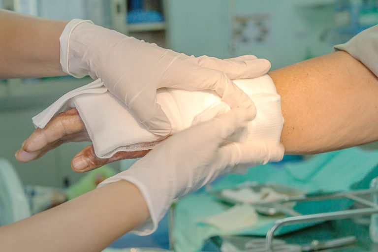 Dressing burned wound