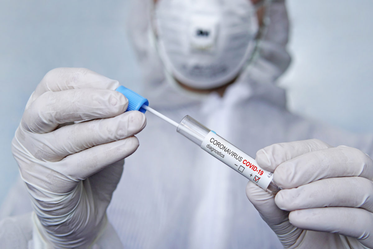 Coronavirus 2019 nCoV Sample. New Epidemic Corona Virus. Corona virus outbreaking. Corona Virus in Lab. Scientist hold tube with Test with Virus Name Coronavirus. sputum examination