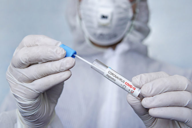 Coronavirus 2019 nCoV Sample. New Epidemic Corona Virus. Corona virus outbreaking. Corona Virus in Lab. Scientist hold tube with Test with Virus Name Coronavirus. sputum examination