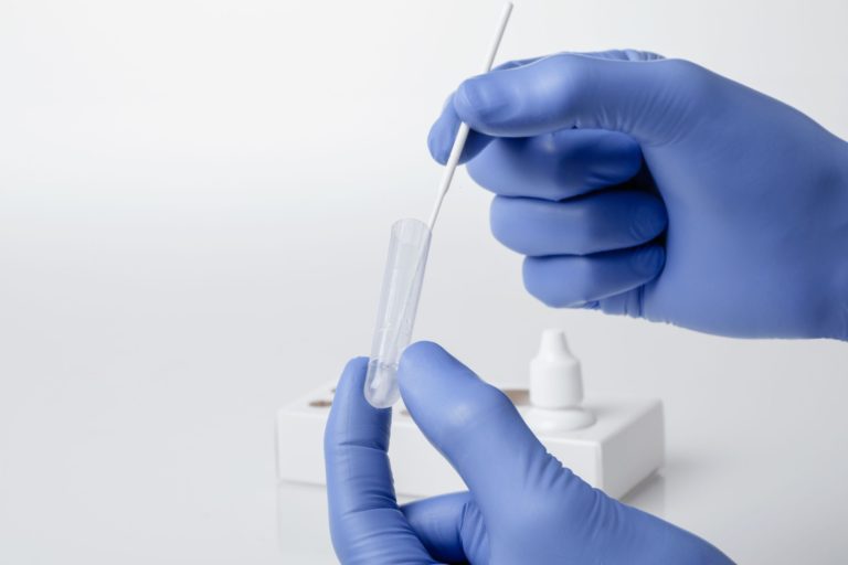 Ilustracne foto_ag test_zdroj_siemens healthineers.jpg
