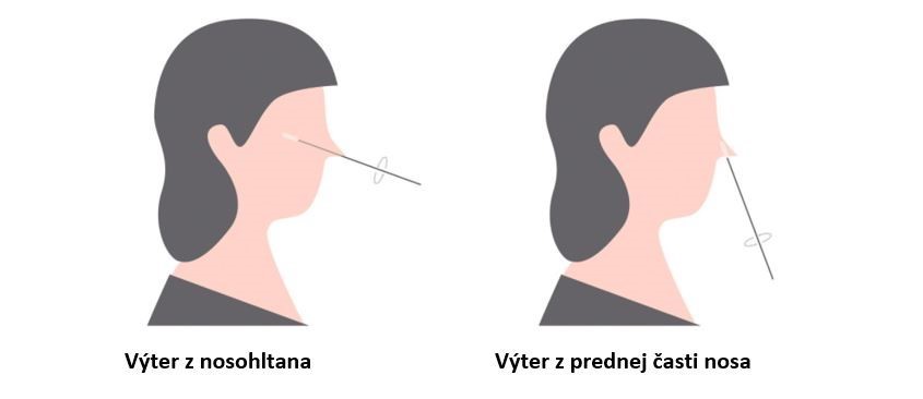 Vytery. zdroj_siemens healthineers.jpg