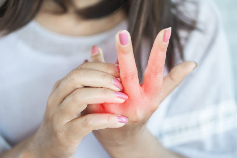 Close Up Of Woman With Hands Itchy