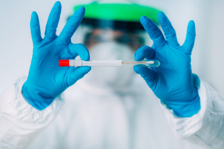 Koronavírus, COVID 19, PCR test