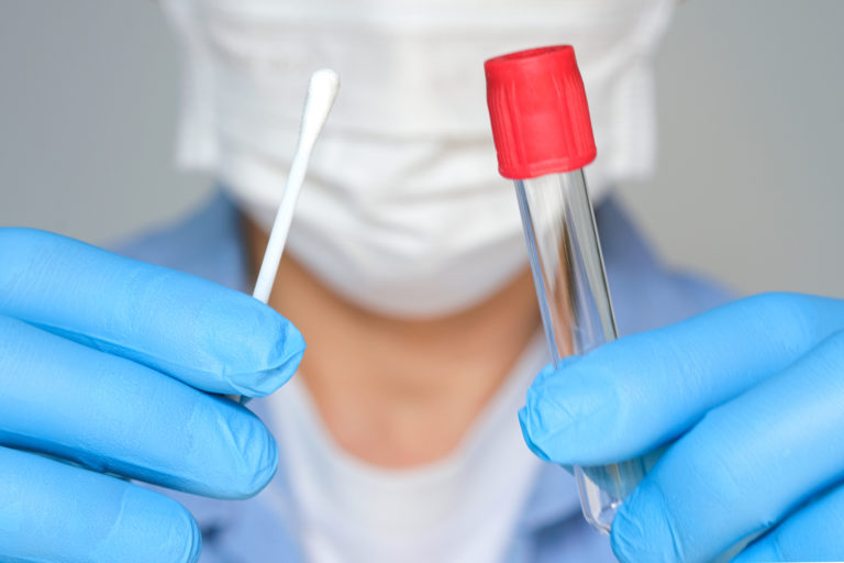Koronavírus, COVID 19, PCR test
