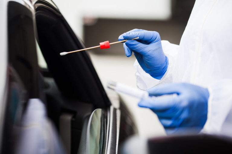 Koronavírus, COVID 19, PCR test