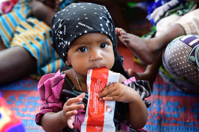 CHD.NUTRITION.Dosseye.18.05.2021.UNICEF.FrankDejongh.5175
