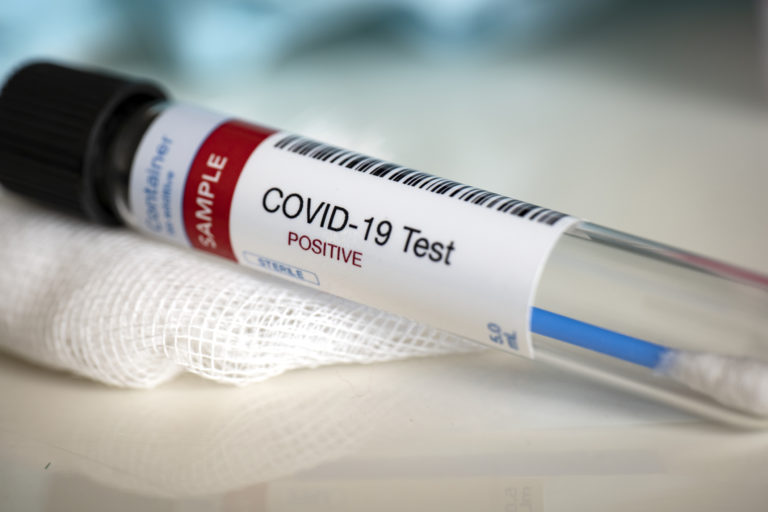 Pozitívny test, koronavírus