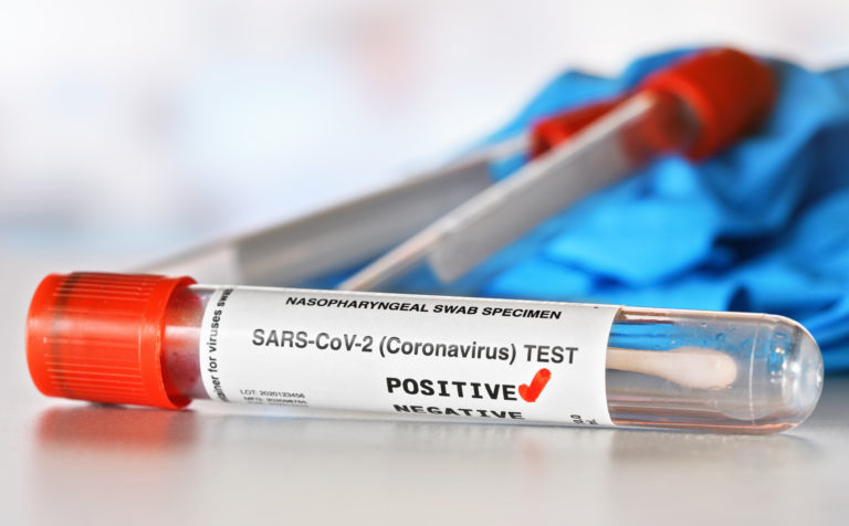 Pozitívny test, koronavírus