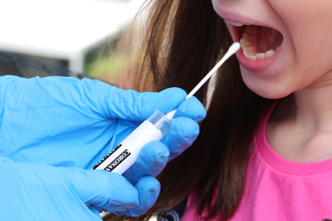 PCR testovanie
