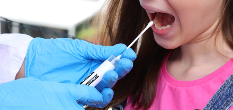 PCR testovanie
