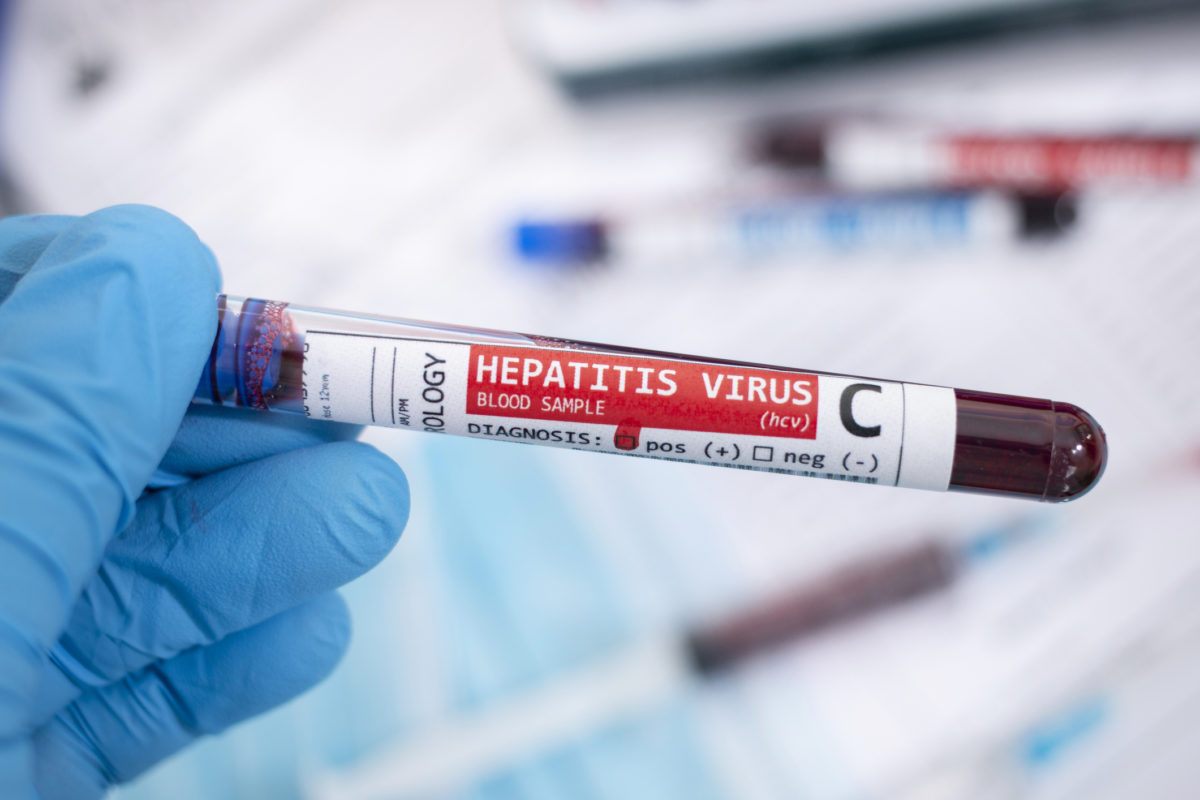 Hepatitída