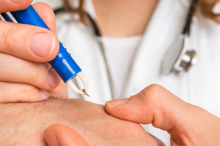 Doctor removing a tick with tweezers from hand of patient