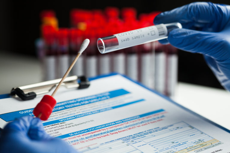 PCR test