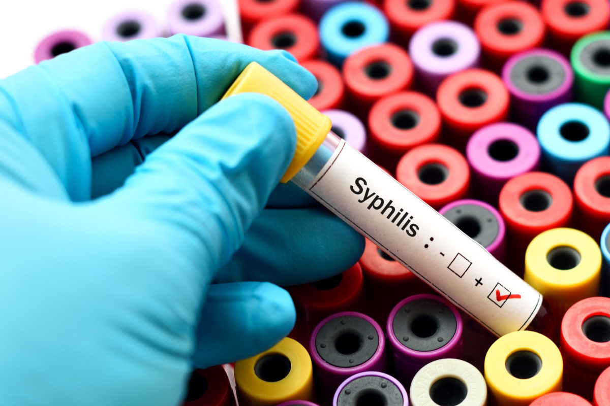 Syfilis