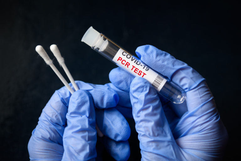 PCR test