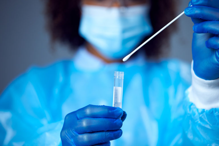 PCR test, koronavírus