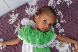 UNICEF YEMEN 2021 June Al Sadaqa Hospital Malnutrition Cases Gos