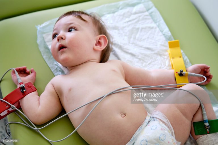 EKG, bábätko