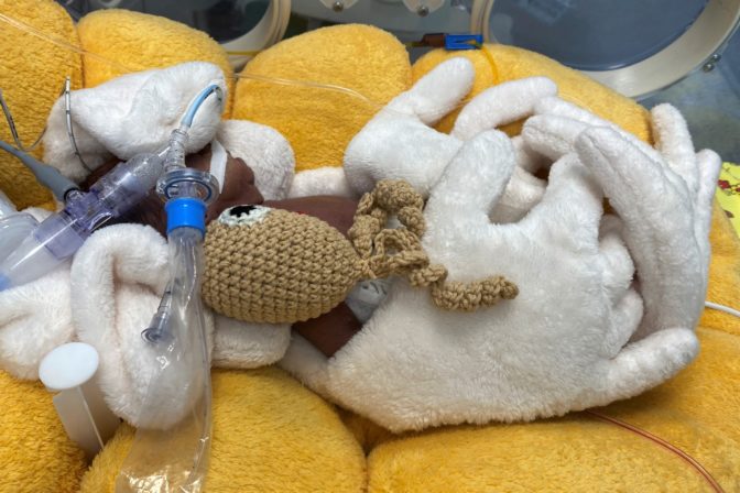 NAVA ventilácia, novorodenec