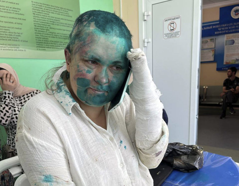 Zbitá ruská novinárka