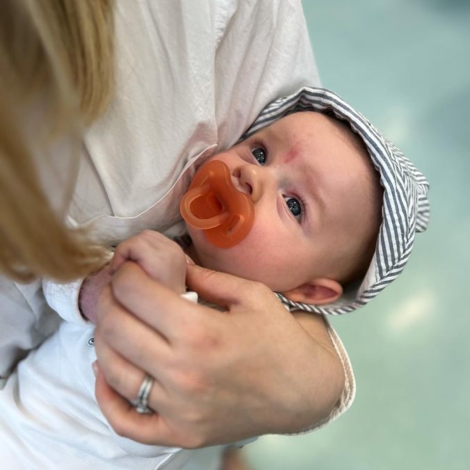 Keď poslankyňa NR SR Vladimíra Marcinková porodila svojho syna, všimla si červený fliačik na tvári bábätka.