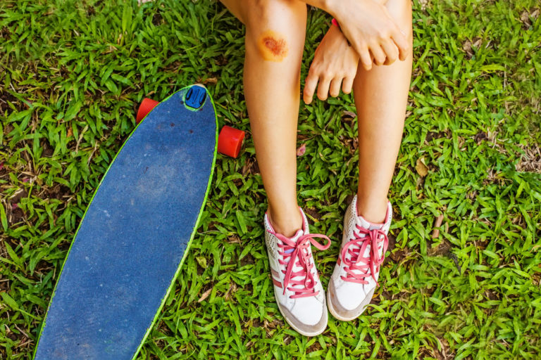 Female skater with an injured leg