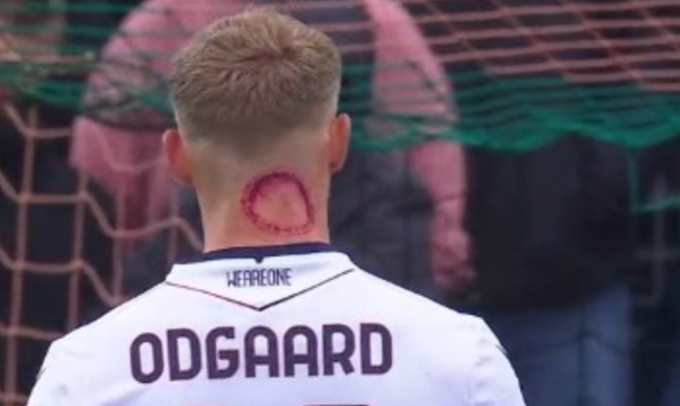 Jens Odgaard