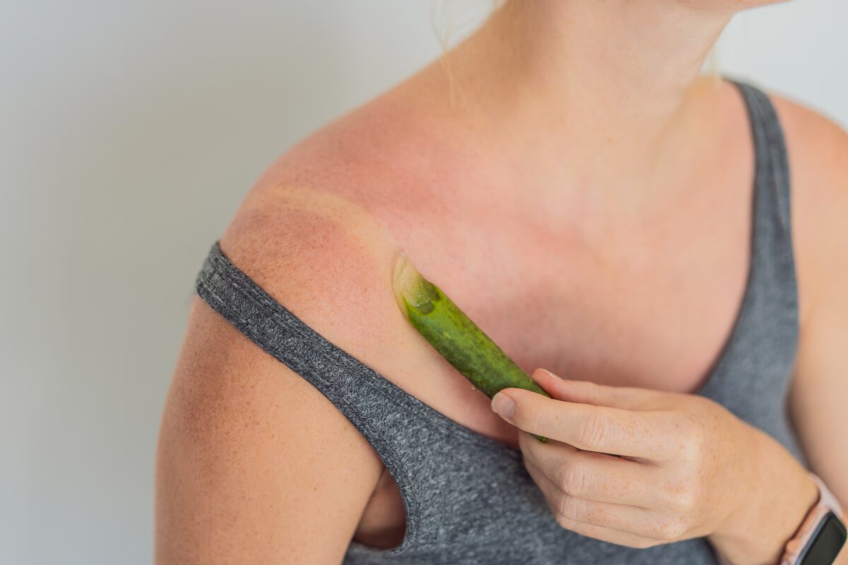 aloe vera na pokožku
