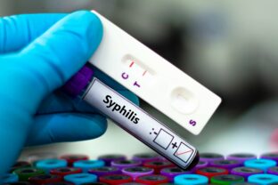 Syfilis