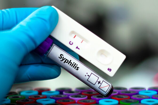 Syfilis