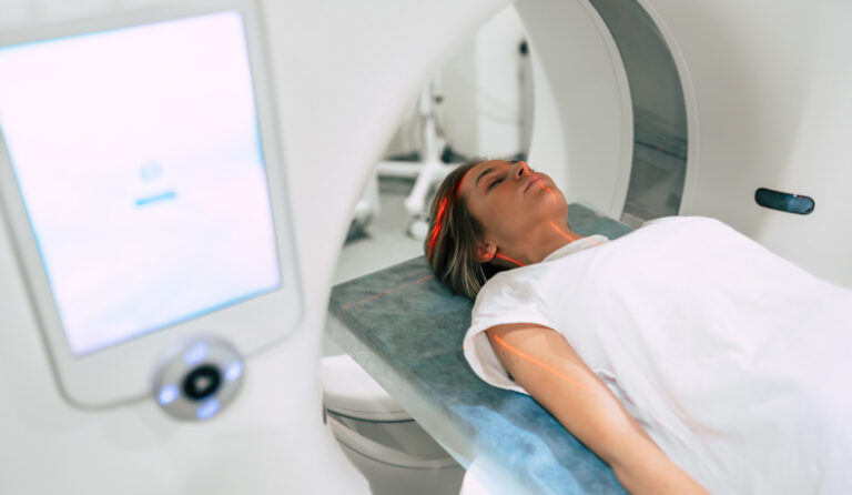 žena, MRI, magnetická rezonancia, skleróza multiplex