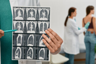 Pulmonologist showing CT scan of lungs female with pneumonia over background lungs exam for patient. Lung disease, pulmonary fibrosis