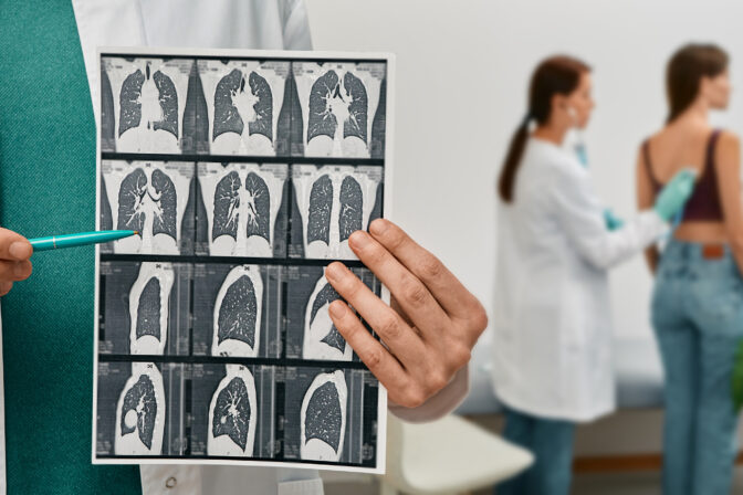 Pulmonologist showing CT scan of lungs female with pneumonia over background lungs exam for patient. Lung disease, pulmonary fibrosis